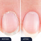 💅✨ NYHET! Tånagelsvampbehandlingspenna – Effektiv & Enkel